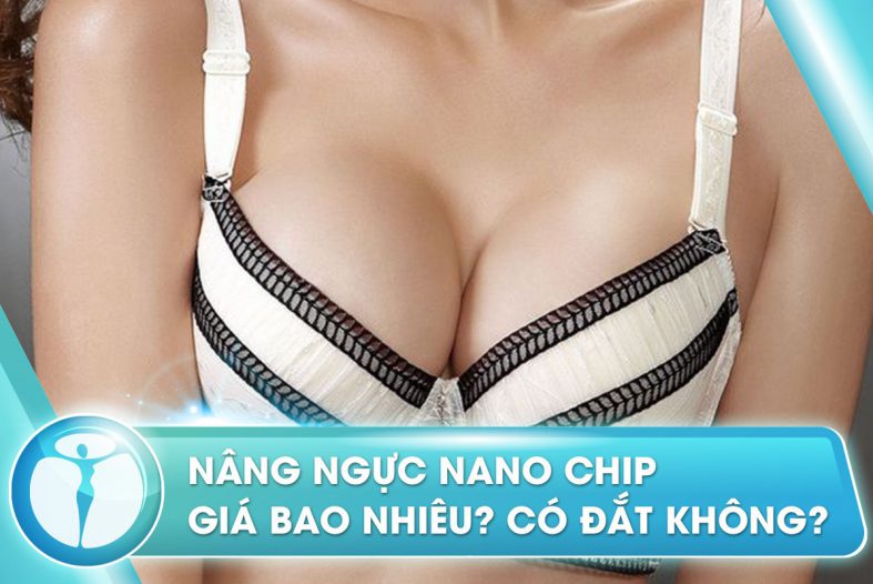 Quản chặt giá nâng ngực bằng phẫu thuật cấy ghép 210422-nang-nguc-nano-chip-phau-thuat-tham-my